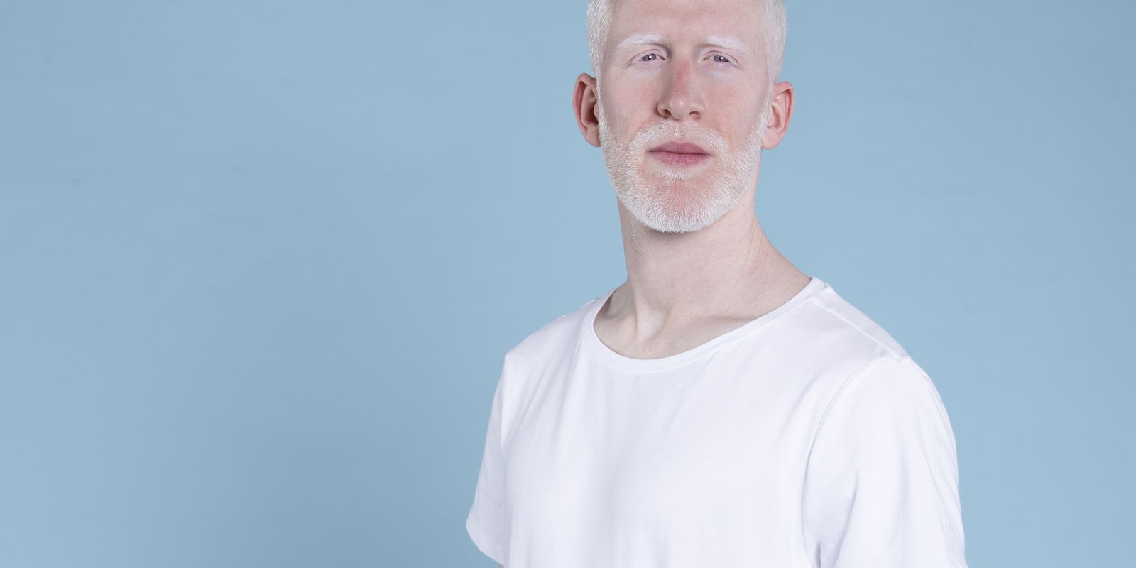 Sancionada lei que cria política de proteção a pessoas com albinismo