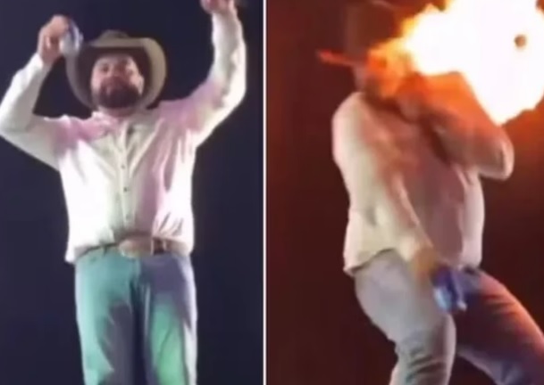 Vídeo: cantor mostra como ficou seu rosto após ser queimado durante show