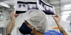 Diagnóstico tardio dá poucas chances de cura do câncer de pulmão