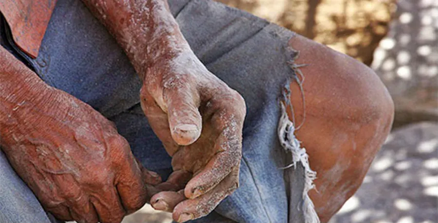 Paraíba tem 19 empregadores na nova “Lista Suja” do trabalho escravo; e combate a escravidão é prioridade de nova procuradora