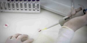 Paciente em SP com suspeita de ebola testa positivo para meningite