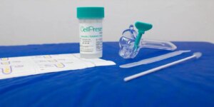SUS detecta quase 10 mil testes positivos para HPV de alto risco